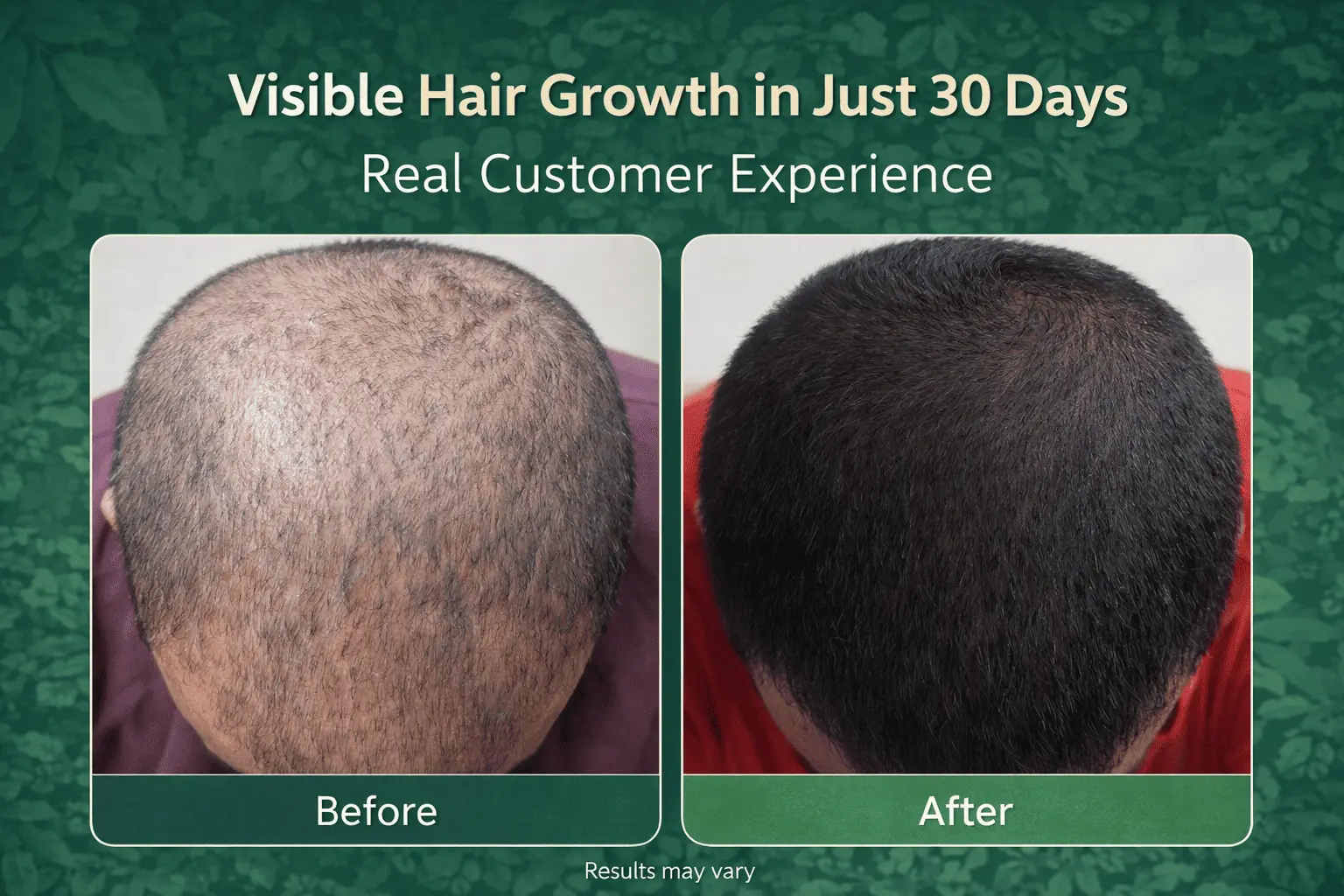 Vigoraahi Herbal hair oil customer experience with visible hair growth results in just 30 days